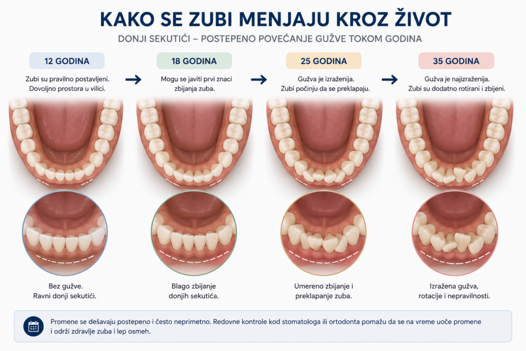 Promene položaja zuba tokom života