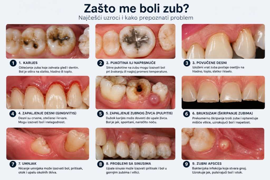 Pacijent sa bolom zuba – mogući uzroci zubobolje