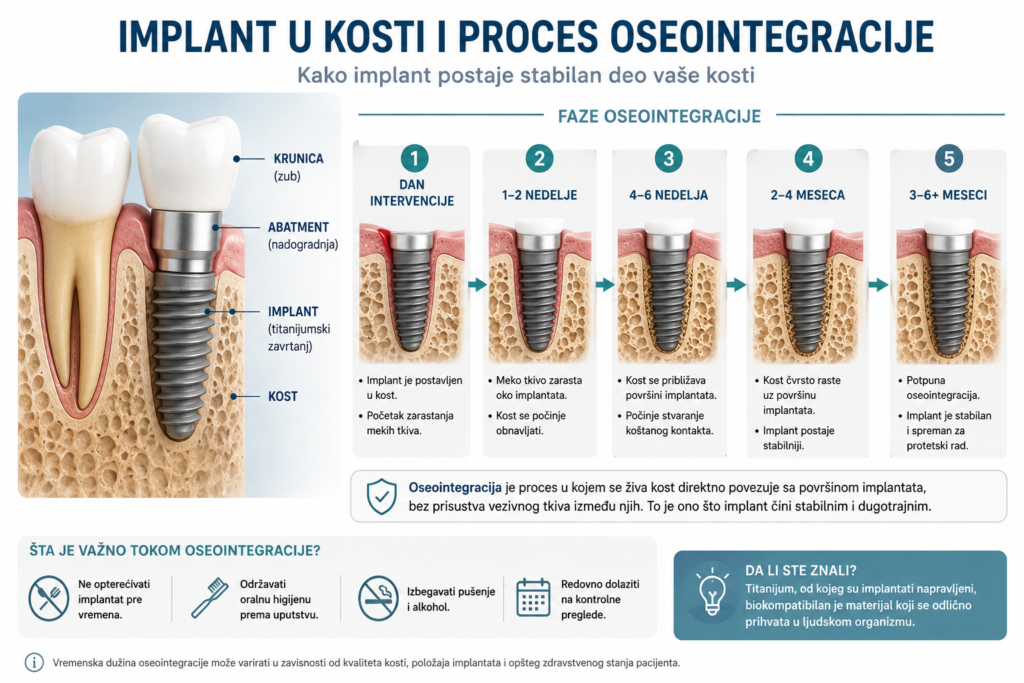Dentalni implantat u kosti i proces srastanja