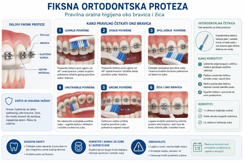 Održavanje higijene tokom terapije fiksnim aparatom