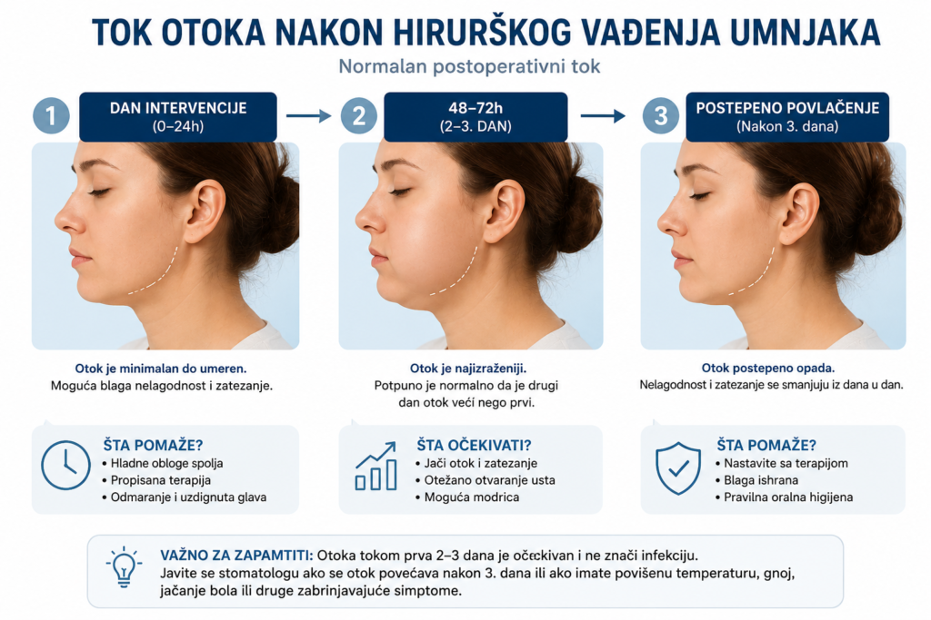 Otok nakon hirurškog vađenja zuba