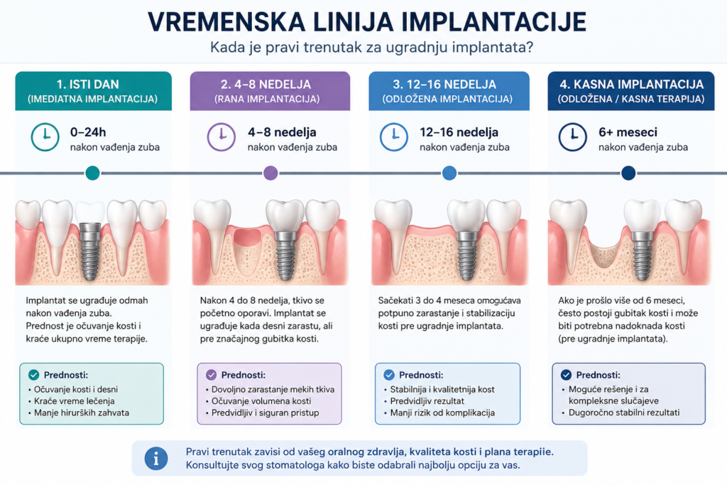 Pravi trenutak za ugradnju implantata nakon vađenja zuba